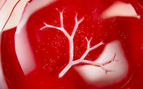 Organ type of image with white "veins" and small bacteria dots in red background, original image by Valeria Azovskaya
