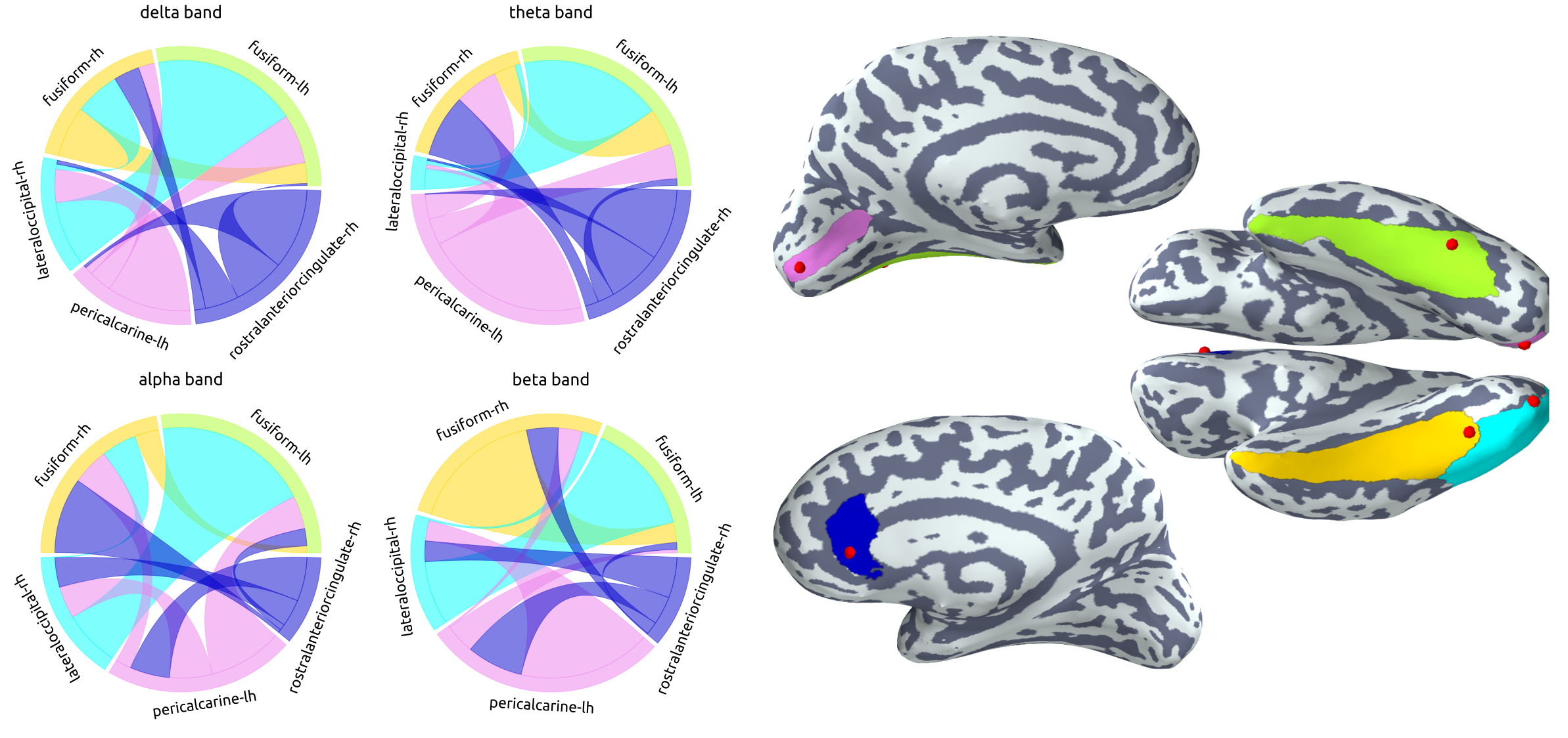 Example of functional connectivity at different frequency bands.