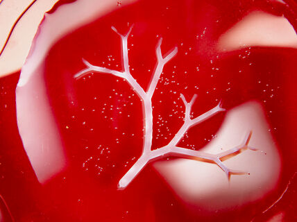 Organ type of image with white "veins" and small bacteria dots in red background, original image by Valeria Azovskaya