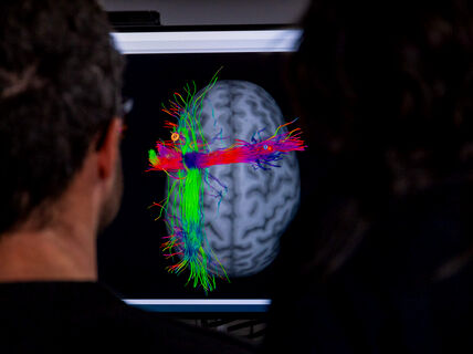 Two people observe a brain scan on a monitor, showing colourful neural pathways in red, green, and blue.