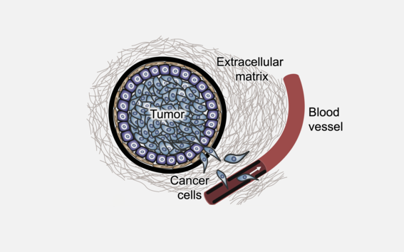 Illustration of spreading cancer cells.