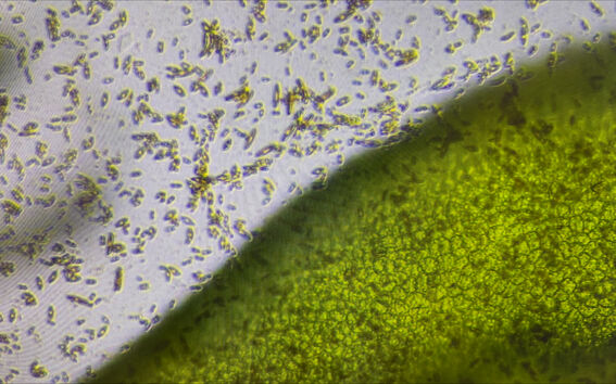 Microscope view of green plant tissue beside many tiny rod-shaped bacteria on a pale background