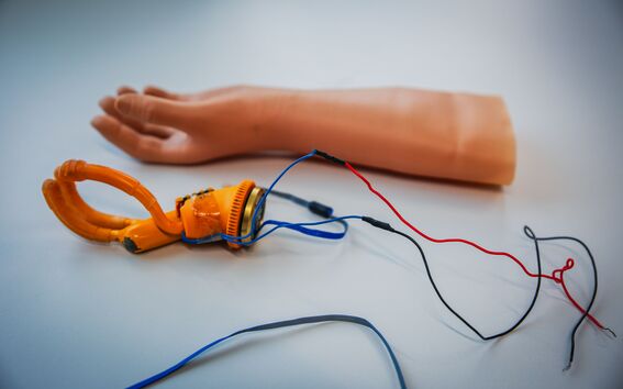 Prototype prosthetic hand and arm on a table, with orange clamp-like hand and loose red, blue and black wires.