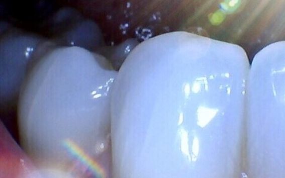 Aalto University/iDenta group