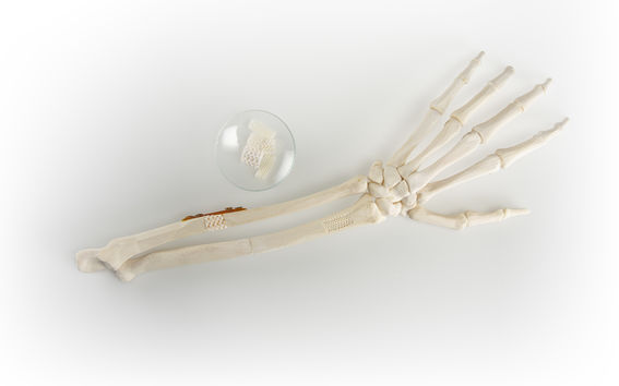 3D printed implants for bone regeneration / Photo: Valeria Azovskaya