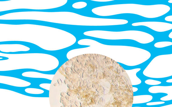 MIkroskooppikuva bakteerista