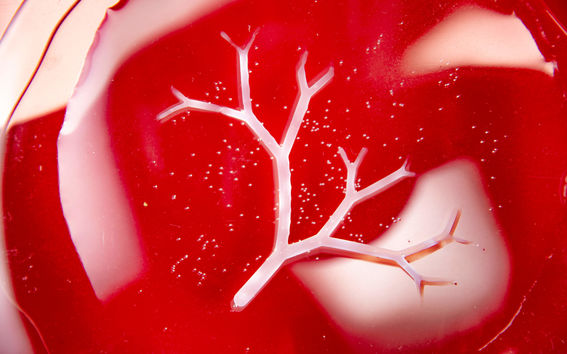 Organ type of image with white "veins" and small bacteria dots in red background, original image by Valeria Azovskaya