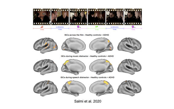 the image shows movie frames and related brain activations