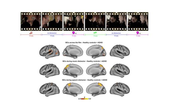 Image adapted from Salmi et al., 2020