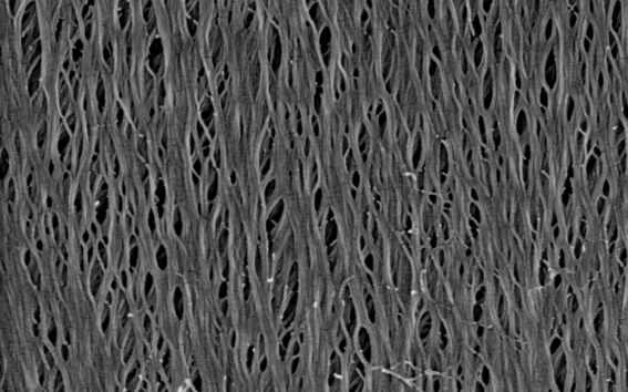 Secondary cell wall structure of nanostructured wood