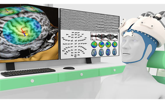 Preliminary scheme of the future TMS device. Picture: Northbay, Helsinki.