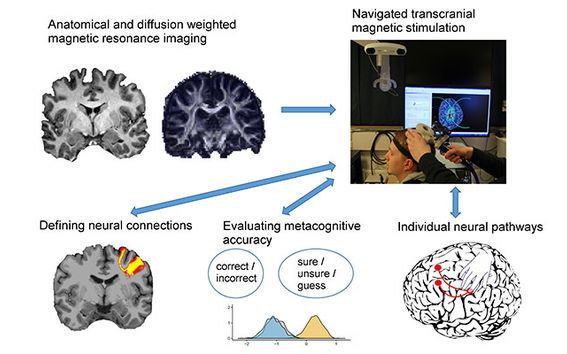 Magnetic stimulation of the brain improved awareness of subject's