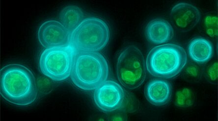 Fluoresenssimikroskooppikuva Calcofluor Whitella (syaani) ja Nile Redillä (vihreä) värjätyistä hiivasoluista.