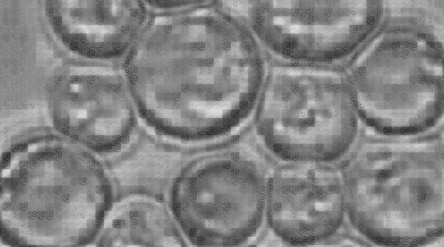 A mosaic of microscopy images of yeast cells.