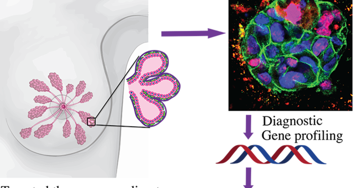 Novel 3D matrix will allow predictive and effective breast cancer ...