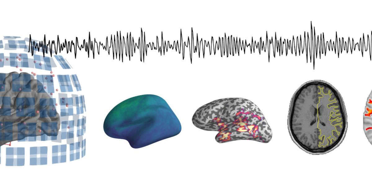 Multimodal Imaging of Aging | Aalto University