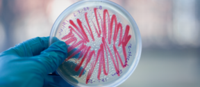 Bacteria_PhotoBy_EveliinaJuuri
