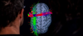 Two people observe a brain scan on a monitor, showing colourful neural pathways in red, green, and blue.