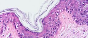 Microscope image of wavy skin tissue layer, pink and purple cells forming dense clusters
