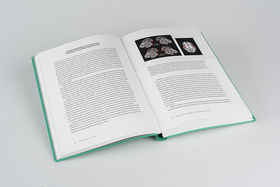 Esimerkkiaukeama Aivoaakkosista, jossa kuvaa ja tekstiä