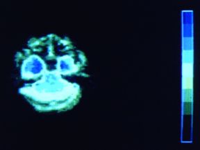 Ensimmäisiä magneettikuvia