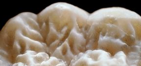 Lähiotos orangin poskihampaasta. Kuva: EVO-DEVO -tutkimusryhmä.