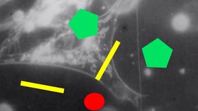 Geometric shapes (two thick yellow lines, a red circle and two turquoise pentagons) float above grainy black and white microscopy footage of biological cells and cellular processes.