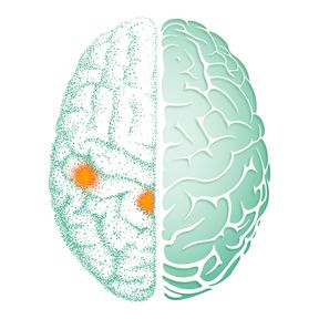 Aivot ylhäältä kuvattuna. Kuvassa myös kaksi aktivoitunutta aivoaluetta aivojen tuntoaivokuorella.