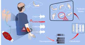 The visual summary shows how noise in HD‑EMG disrupts MU decoding and causes misclassification in intended wrist flexion tasks.