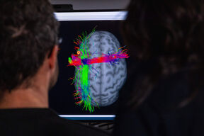 Kaksi ihmistä tarkastelee aivokuvia näytöllä, jossa näkyy värikkäitä hermoratoja punaisena, vihreänä ja sinisenä.