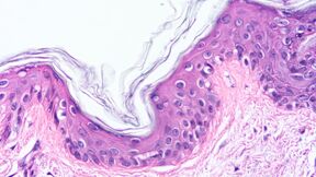 Microscope image of wavy skin tissue layer, pink and purple cells forming dense clusters