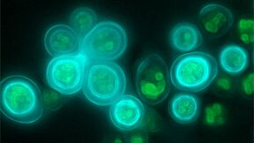Fluoresenssimikroskooppikuva Calcofluor Whitella (syaani) ja Nile Redillä (vihreä) värjätyistä hiivasoluista.
