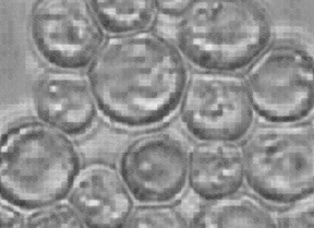 A mosaic of microscopy images of yeast cells.