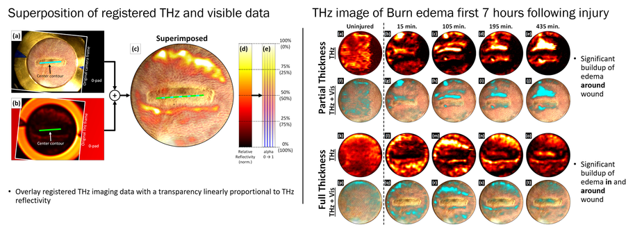 Burn Severity assessment