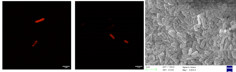 Microscopy analysis of recombinant protein secretion in Komagataeibacter spp.