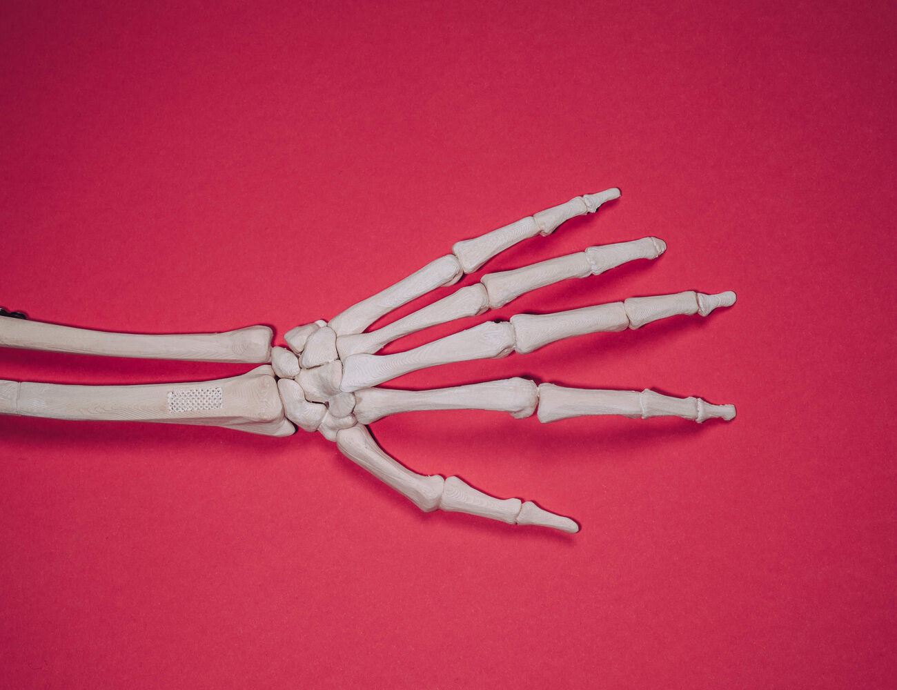 3D arm bone
