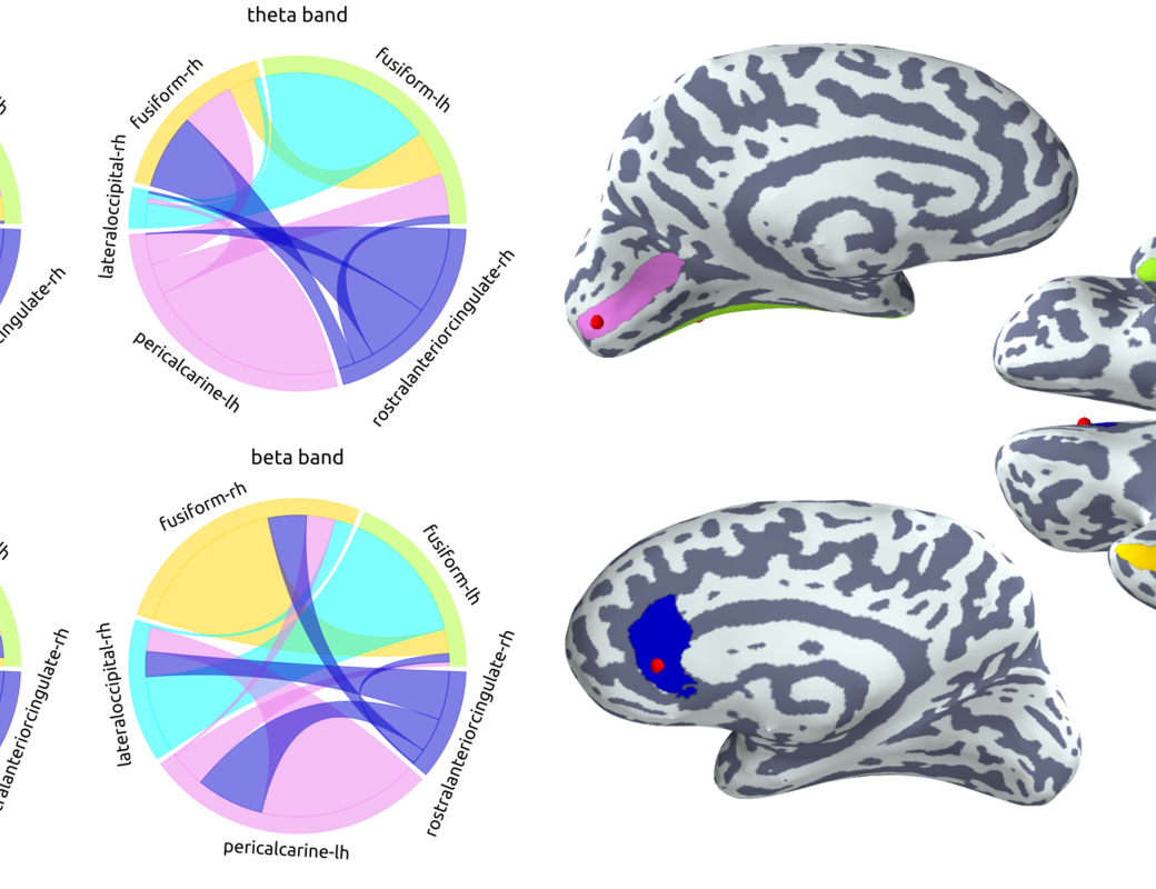 Example of functional connectivity at different frequency bands.