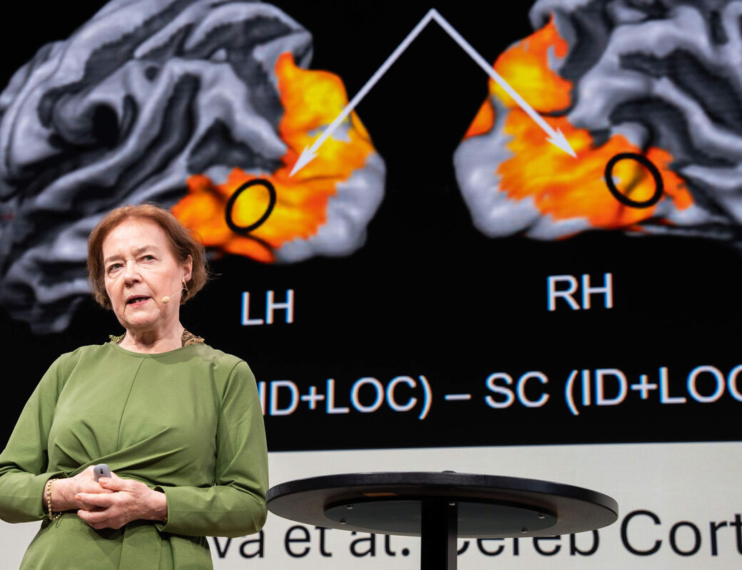 Speaker in green stands before large brain scan slide with LH and RH labels and orange highlighted regions.