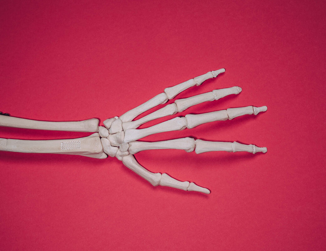3D arm bone