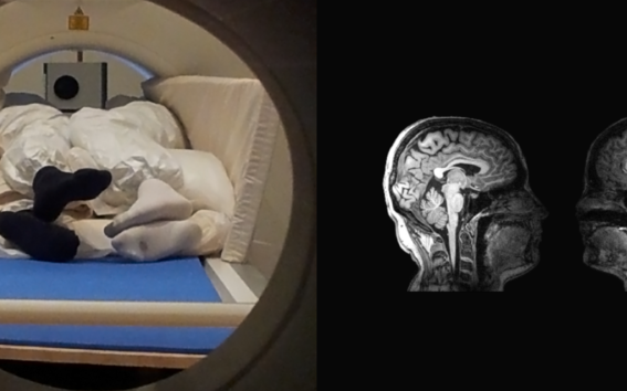 Two people in an mri scanner on the left, with an image of their brains on the right