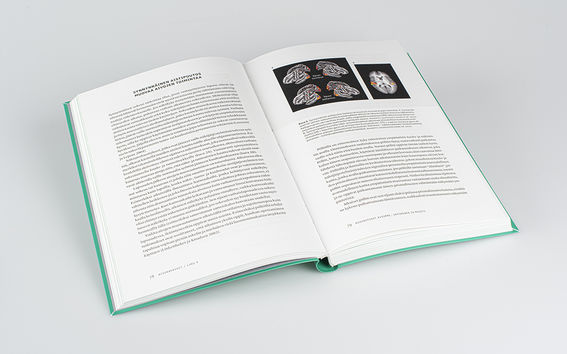 Esimerkkiaukeama Aivoaakkosista, jossa kuvaa ja tekstiä