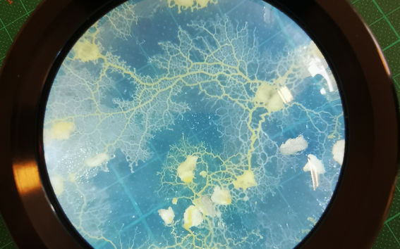 A petri dish showing blue background with yellow organism 