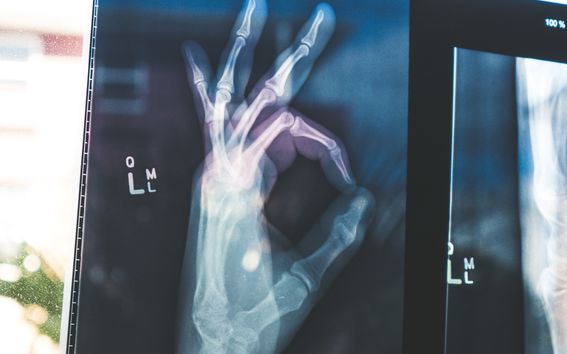 X-ray of hand with fingers making OK sign