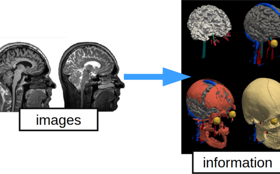 "Accurate and robust whole-head segmentation from magnetic resonance images for individualized head modeling“ by Puonti et al. NeuroImage (2020), licensed under CC-BY-NC-ND