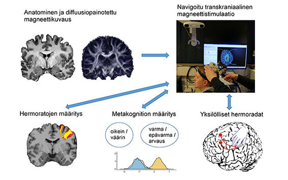 Yhdistelemällä monipuolisesti eri aivotutkimusmenetelmiä on mahdollista huomioida yksilöllinen vaihtelu aivojen anatomiassa. Kuva: Juha Gogulski & Mikko Nyrhinen.