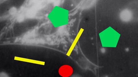 Geometric shapes (two thick yellow lines, a red circle and two turquoise pentagons) float above grainy black and white microscopy footage of biological cells and cellular processes.