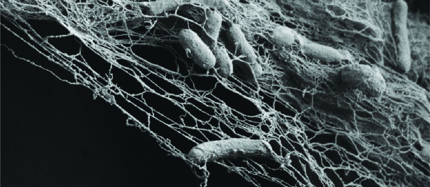 Bakteerien valmistamaa nanoselluloosaa