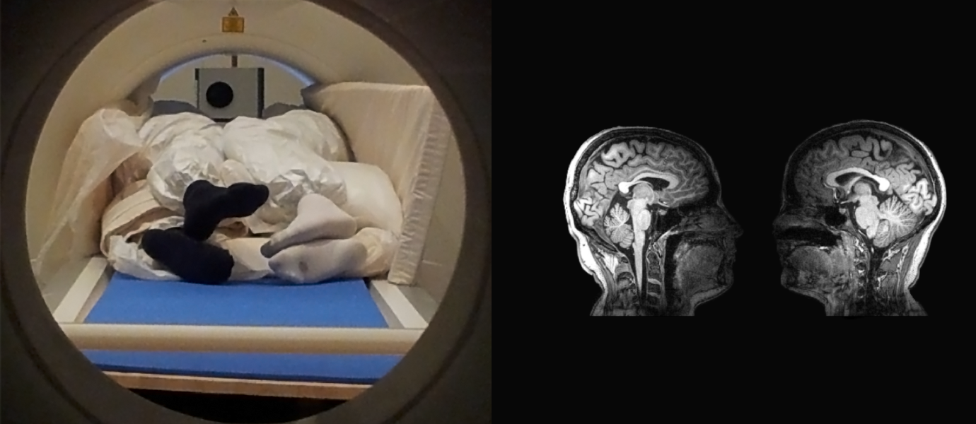 Two people in an mri scanner on the left, with an image of their brains on the right