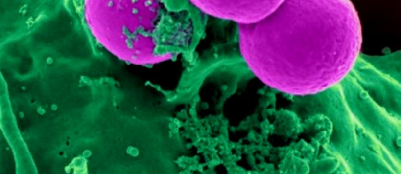 Scanning electron micrograph of a human neutrophil ingesting MRSA.
