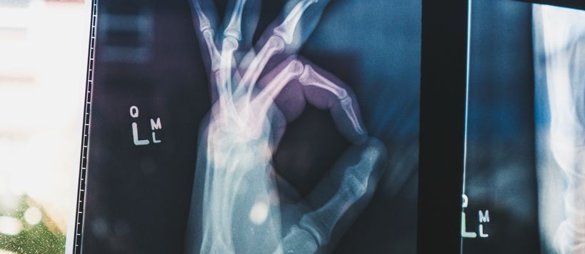 X-ray of hand with fingers making OK sign